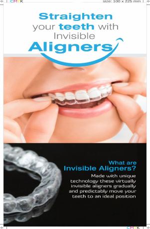 Aligners